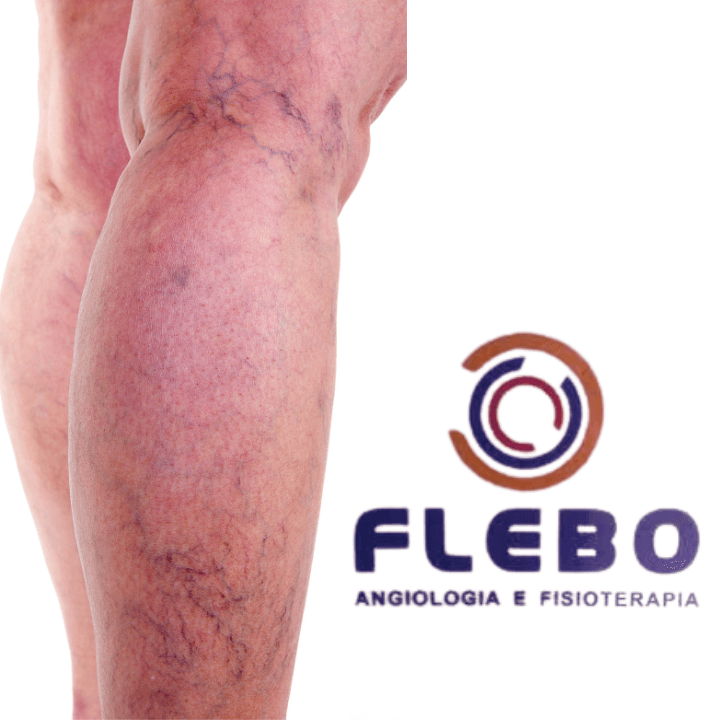 Flebo Clinica Estética Salvador photo