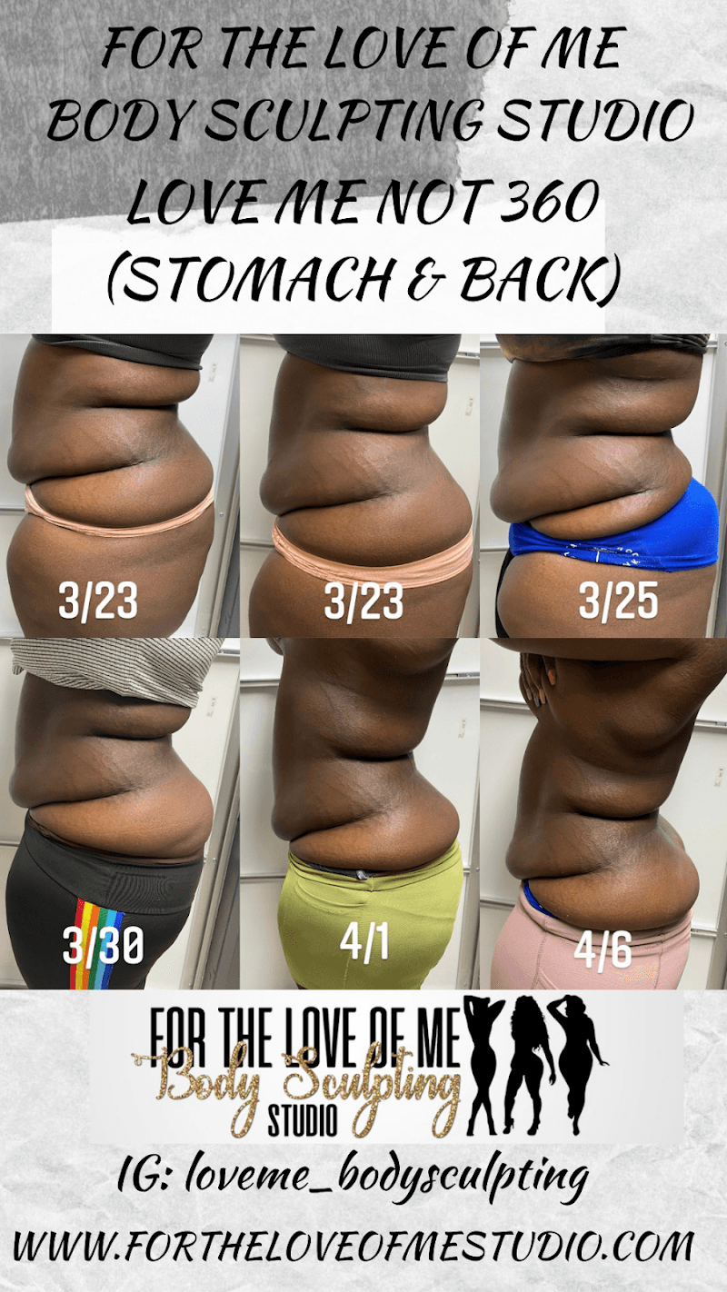 For the Love of Me Body Sculpting Studio Miami Gardens photo