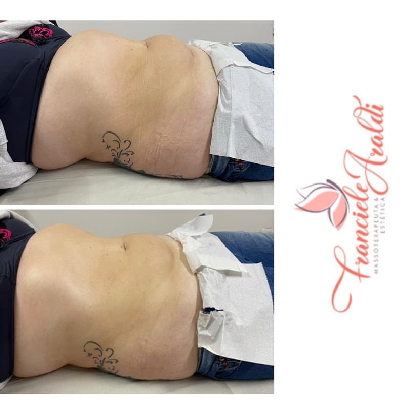 Franciele Araldi Massoterapeuta e Estetica Farroupilha photo