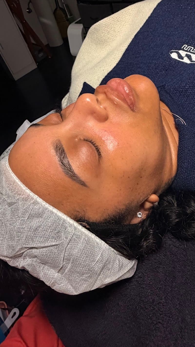 Fresh Face Skin Lab Emeryville photo