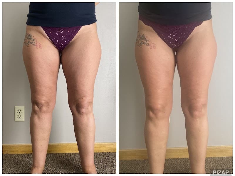 Fresh Start Body Dodge City photo