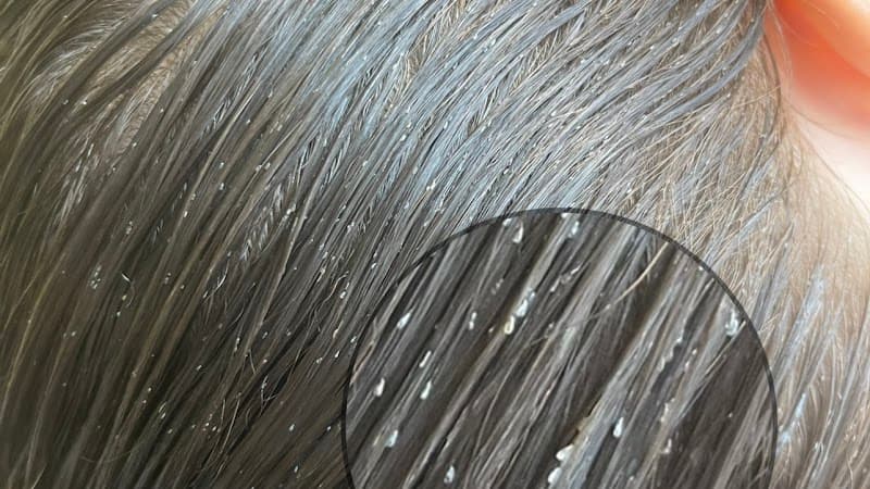 Funny Poux Marseille Castellane est un centre de traitement anti-poux photo