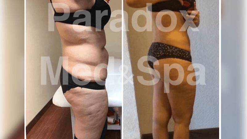 Fusion Med.Spa Paradox Chihuahua photo