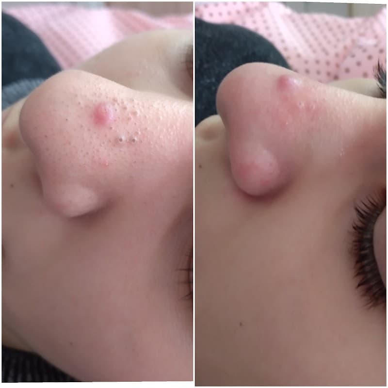 Gabriela Santos Estética Facial Guaíba photo