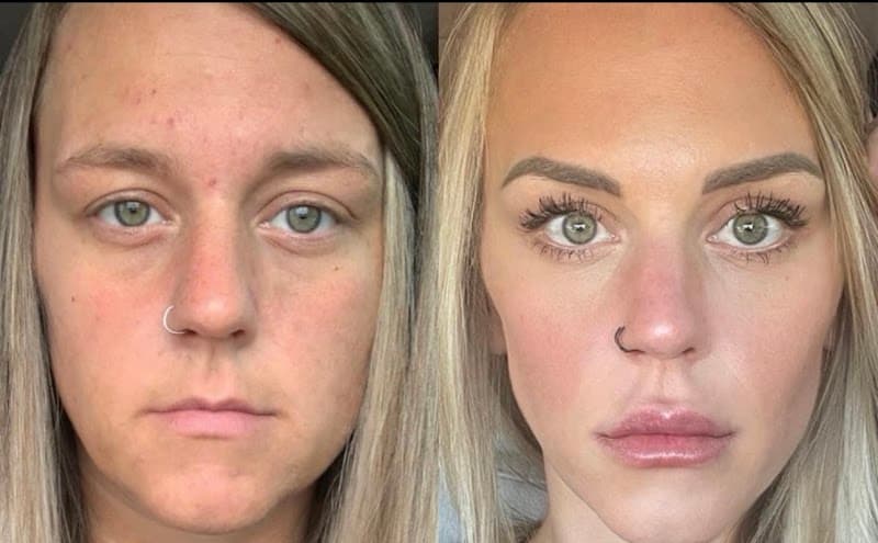 Georgia Center MedSpa Albany photo