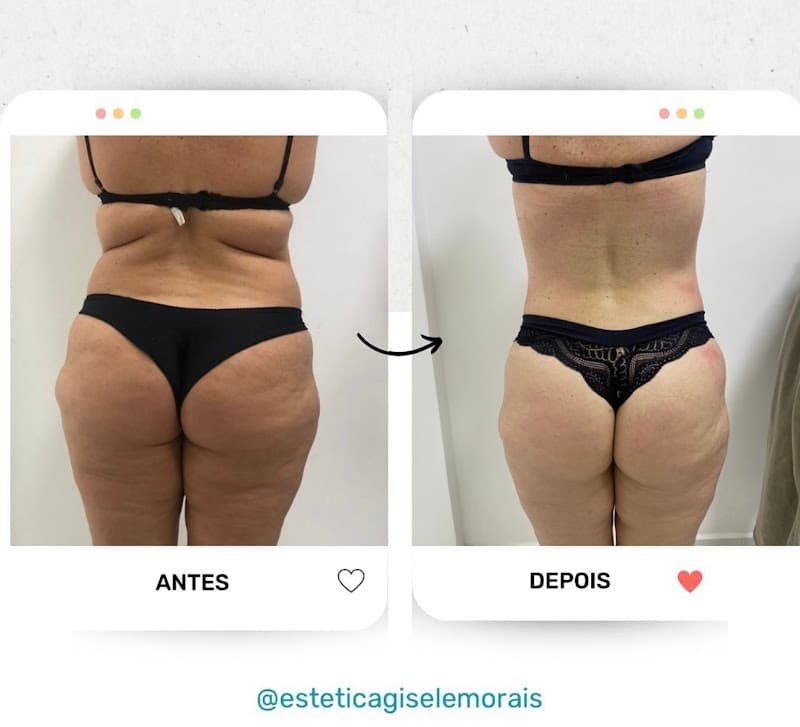 Gisele Moraes Estetica Terapeutica Franca photo