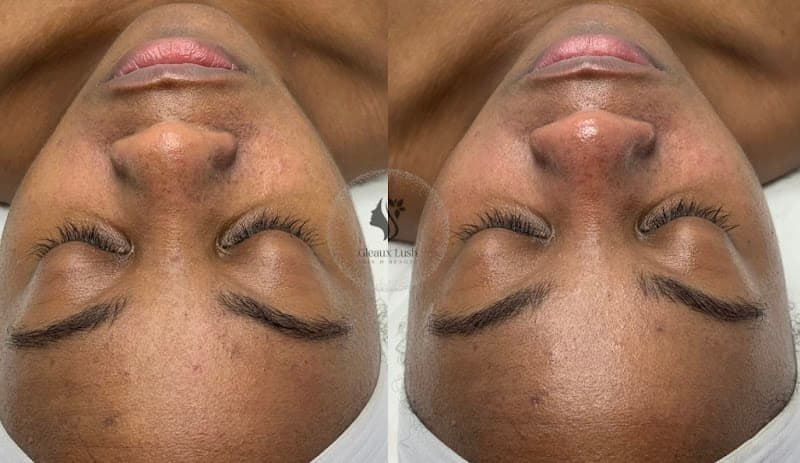 Gleaux Lush Skin and Beauty New Orleans photo