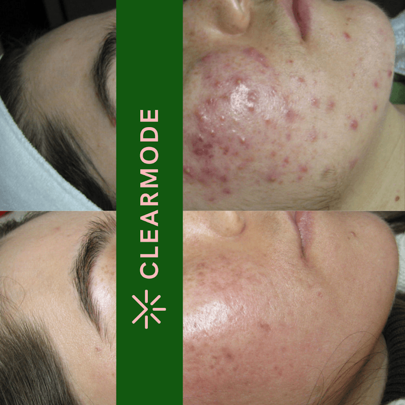 Glowmode Skincare Falls Church photo