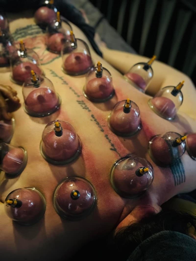 Green - Giảm Đau Cổ Vai Gáy Tại TP.HCM Thủ Đức photo