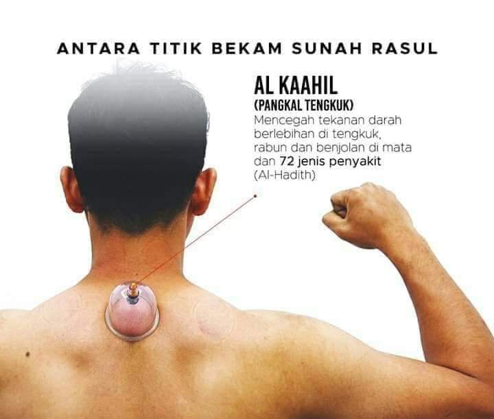 Griya Pijat Bekam Gurah Fasdu Balikpapan photo