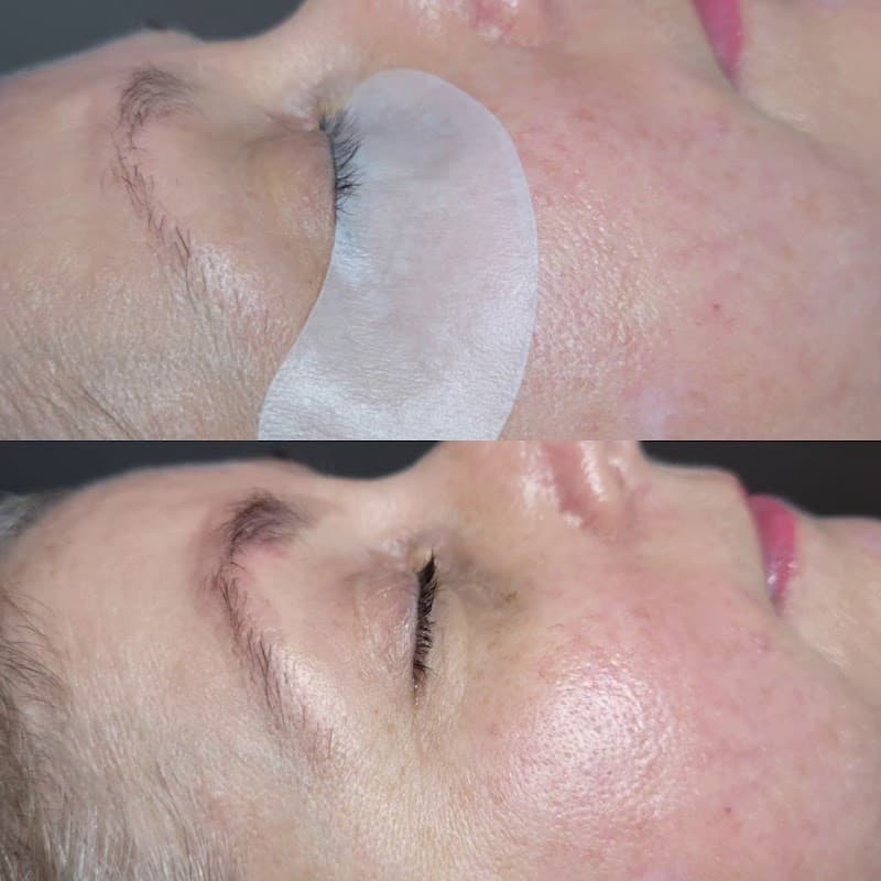 Hailey Thaine Esthetics Elizabethtown photo