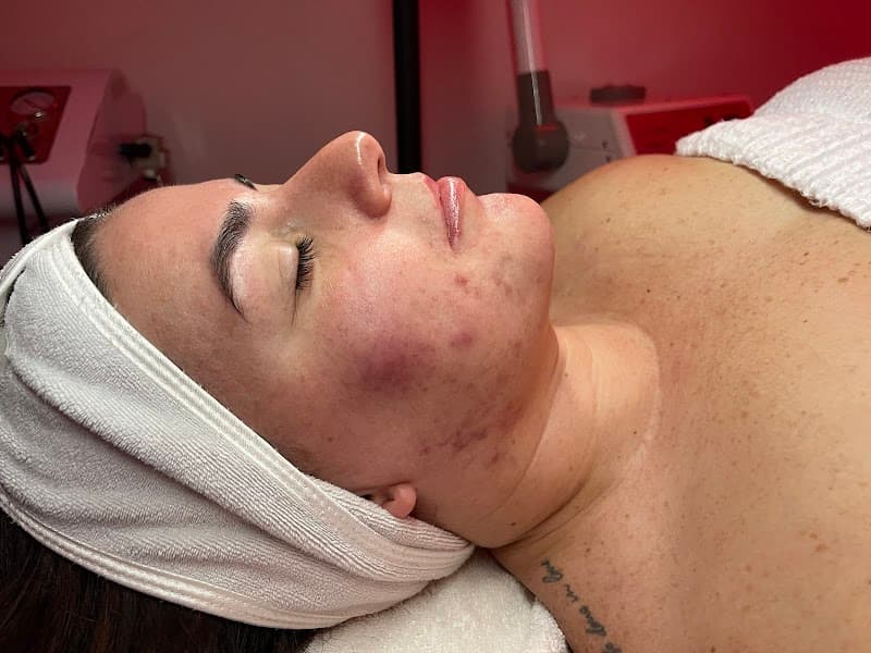 Hanssy Esthetics Lake Worth Beach photo