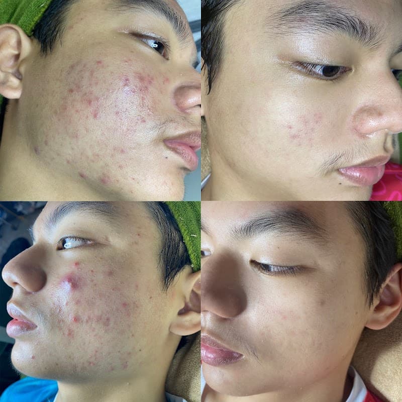 Hậu Spa Chăm Sóc Da Pleiku photo