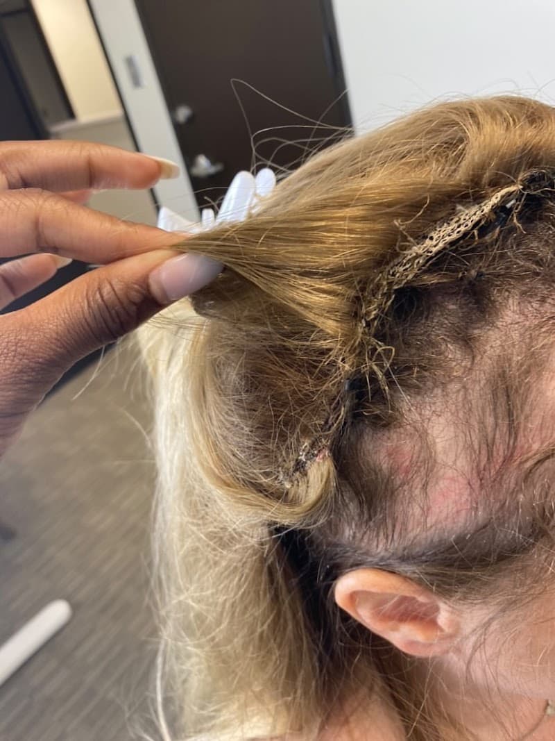 Healthy Hair Clinic Houston photo