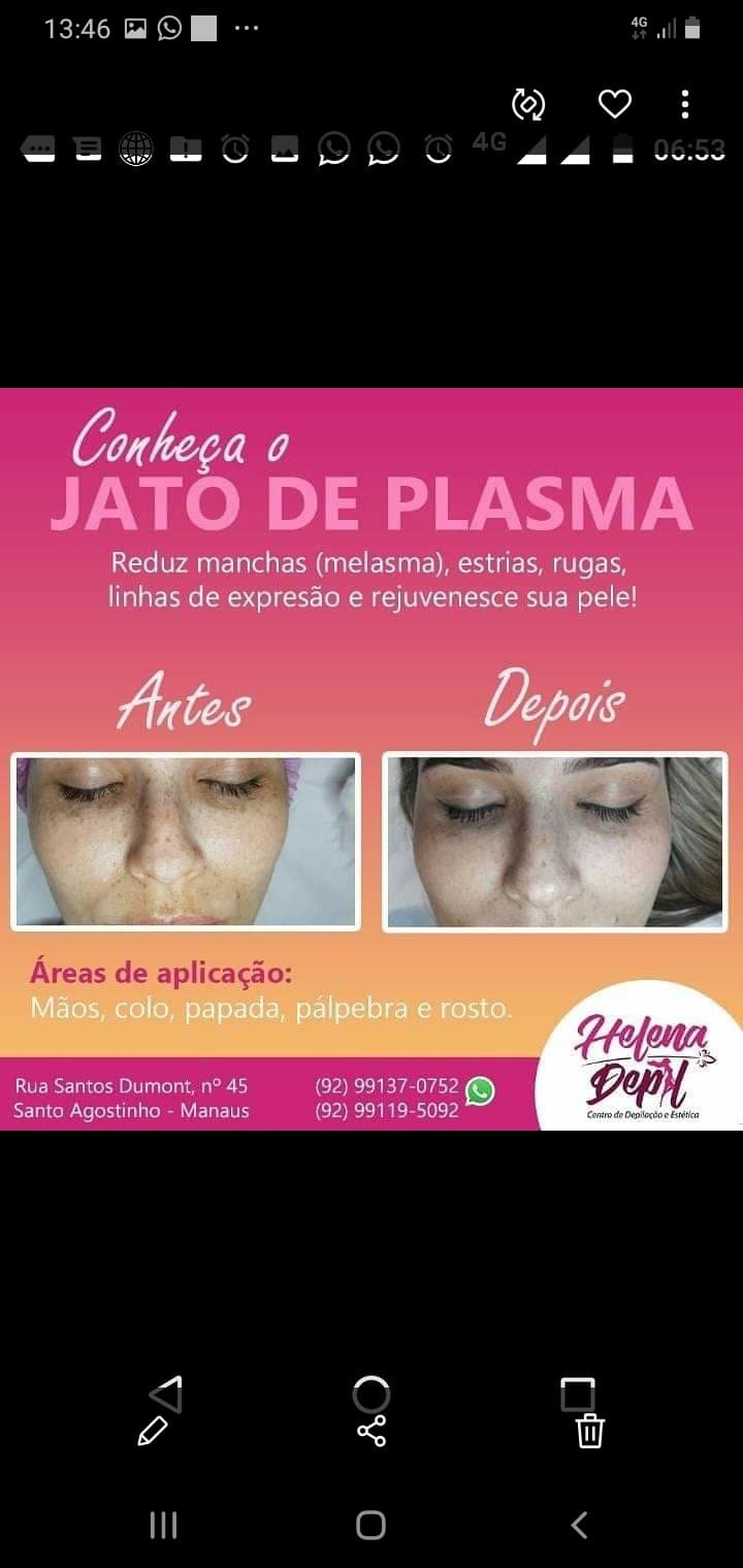 Helenna Depilação Manaus photo
