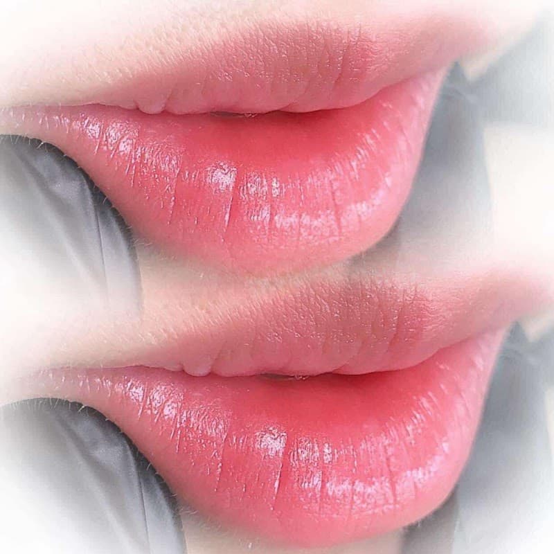 Hery Huỳnh Spa Beauty Thủ Đức photo