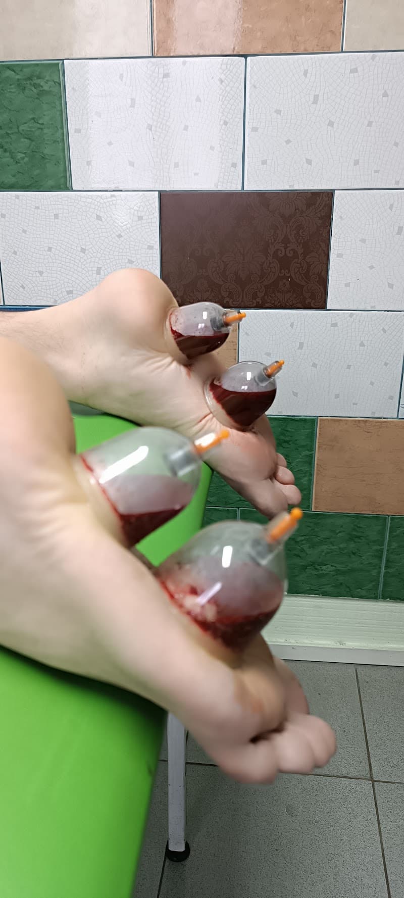 Hijama and All Types of Massage Almaty photo