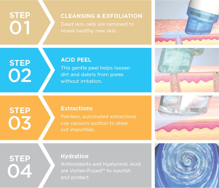 Miguel Hidalgo hydrafacial polanco photo