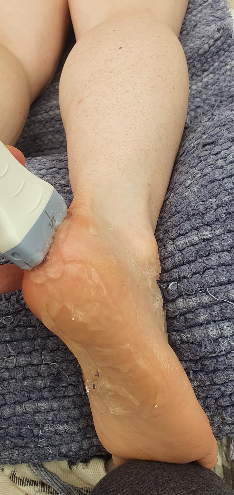 Idrott och Behandlingsmassage - Muskler, Leder och Akupunktur Bollebygd photo