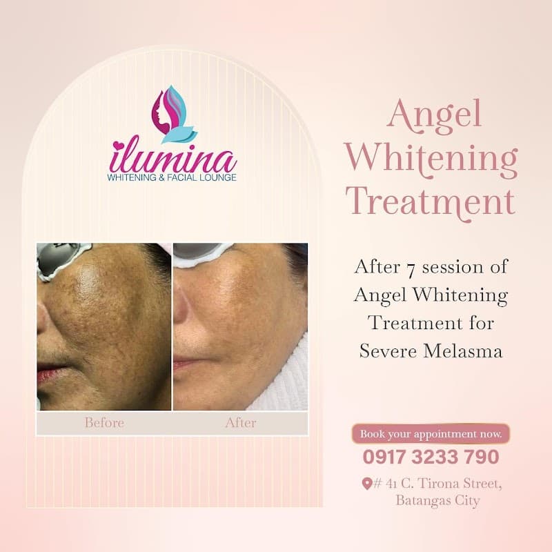 Ilumina Whitening and Facial Lounge Batangas City photo