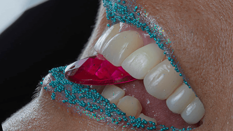 Implantes Dentales Llano Chico photo