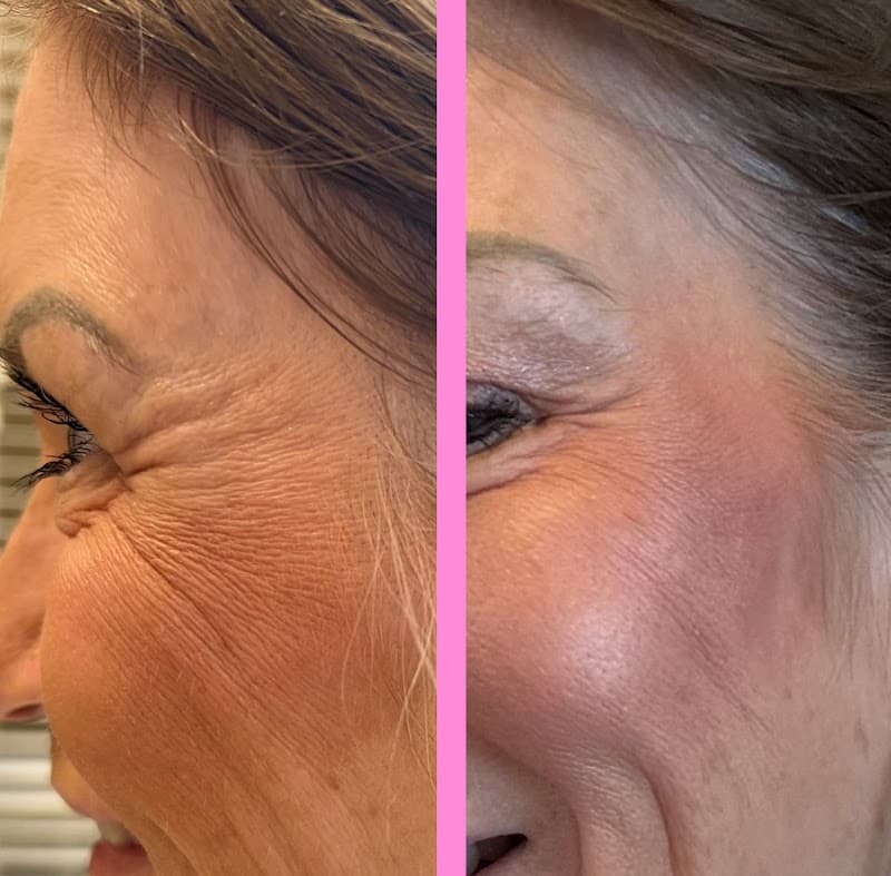 Innova Skin & Wellness Spa Flower Mound photo