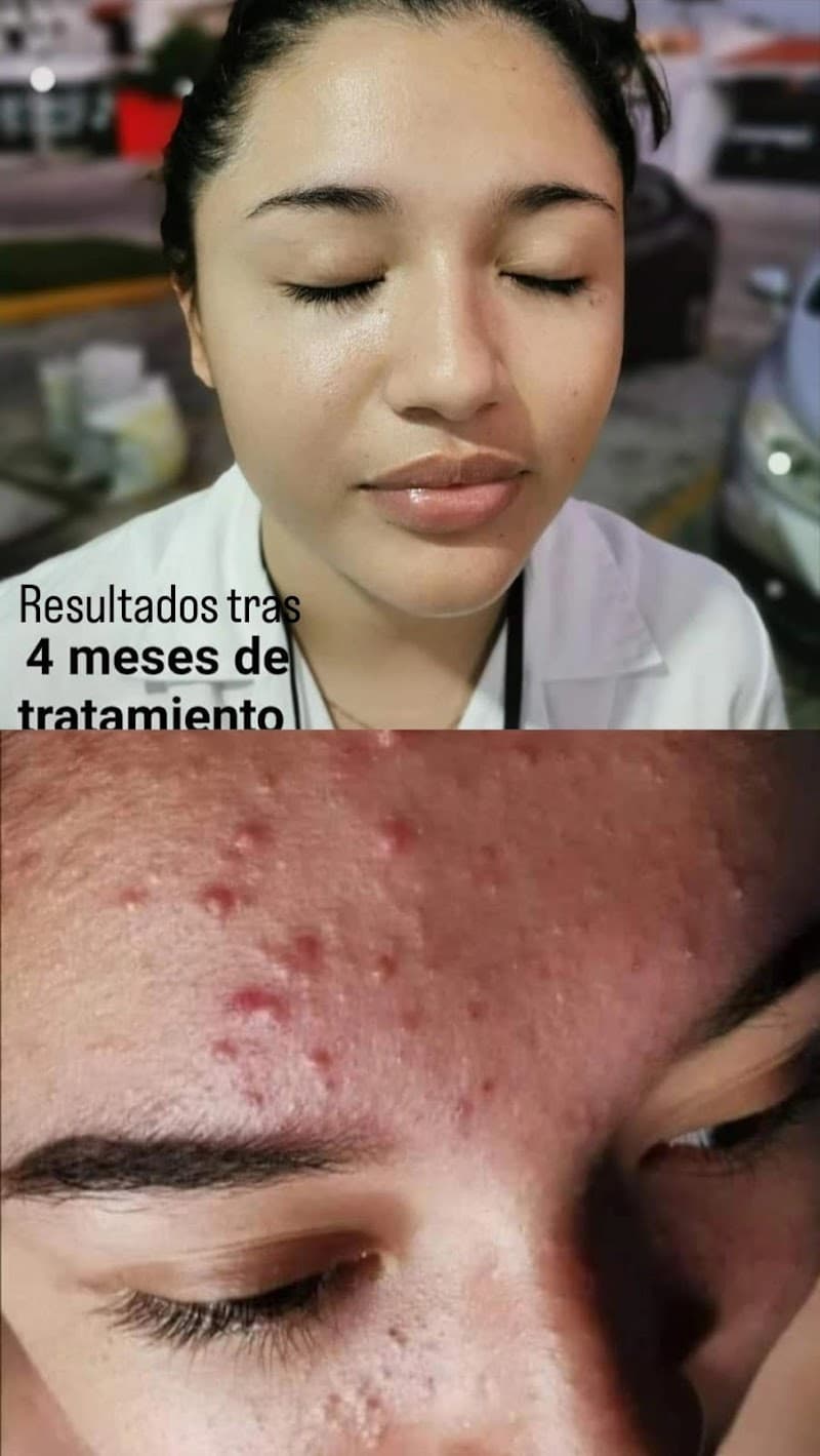 IRUPÉ Mérida photo