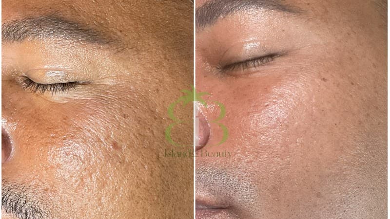 Island of Beauty Miramar photo