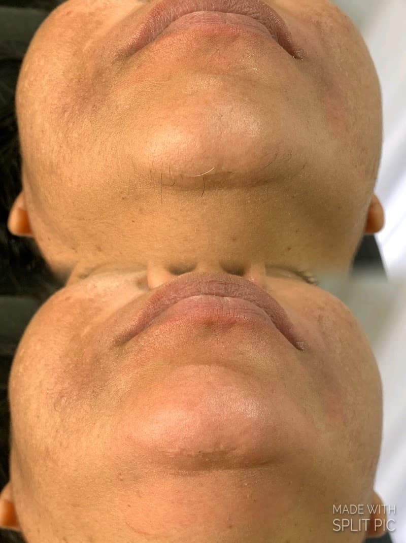 Janaina Depilação Patos photo