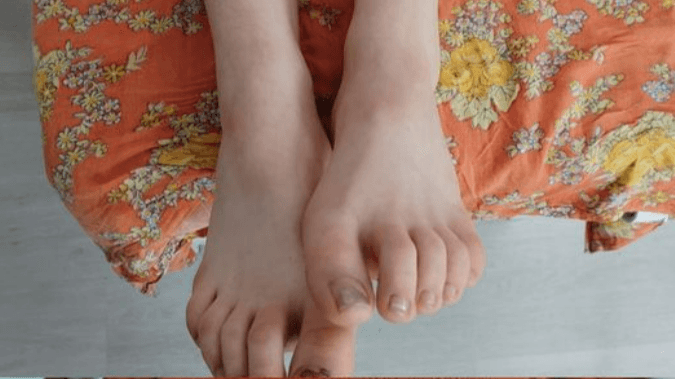 Jäsenkorjaus ja hieronta Allisiini Ylivieska photo