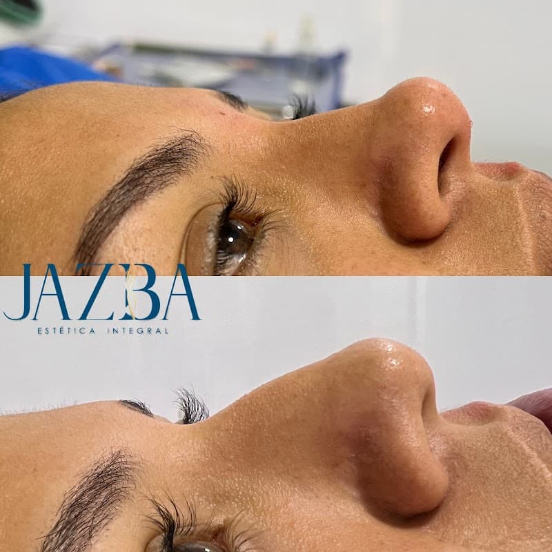 Jazba estetica integral Villa El Salvador photo