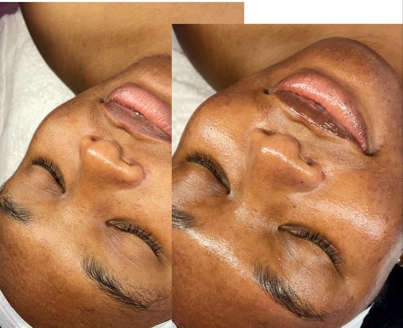 Jonesy Aesthetics Oklahoma City photo