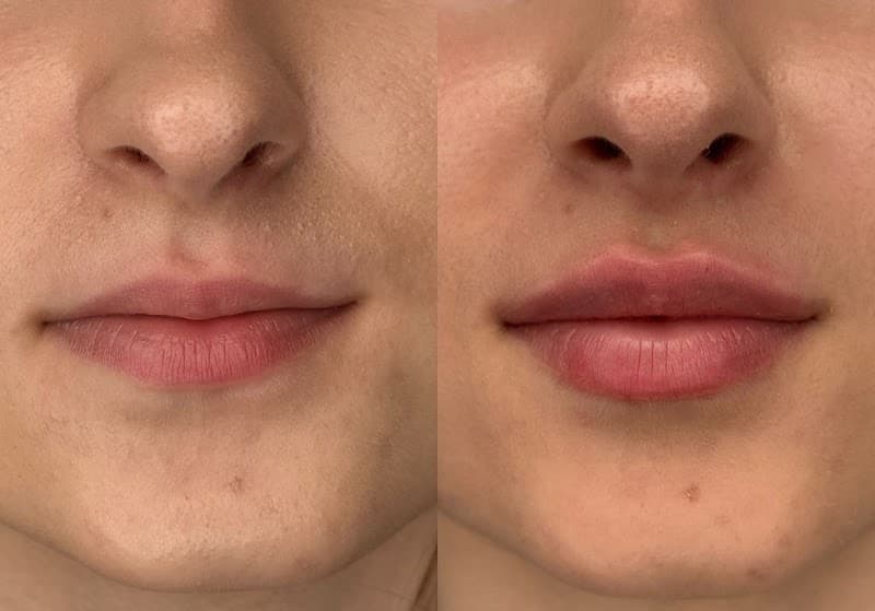 Jordana Karpiuk Azevedo Lajeado photo