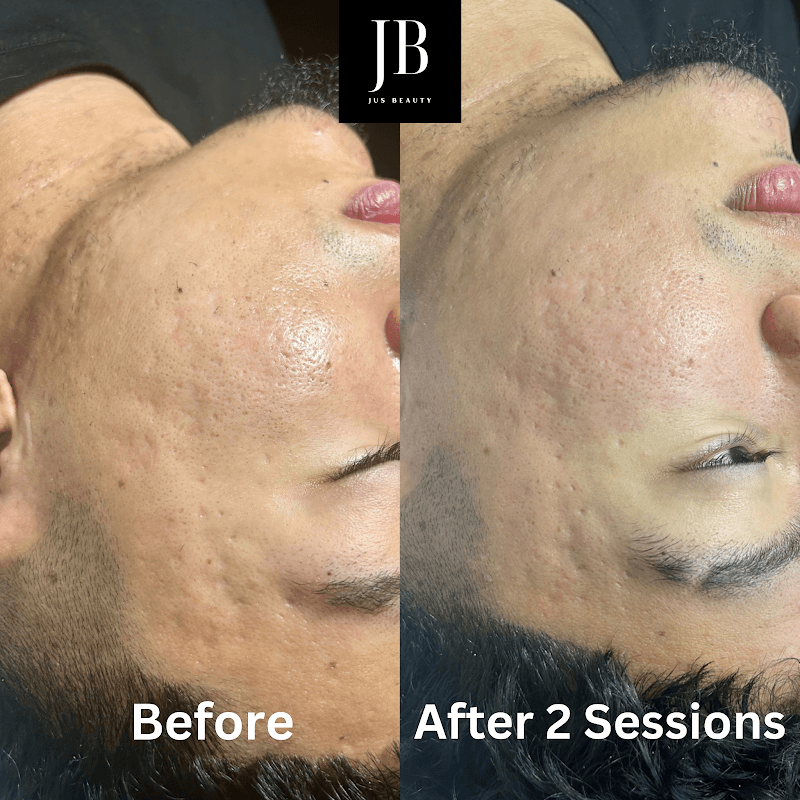 Jus Beauty Esthetician Park Ridge photo