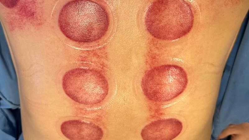 Khỏe Spa- Chuyên massage Trị Liệu Bảo Lộc photo