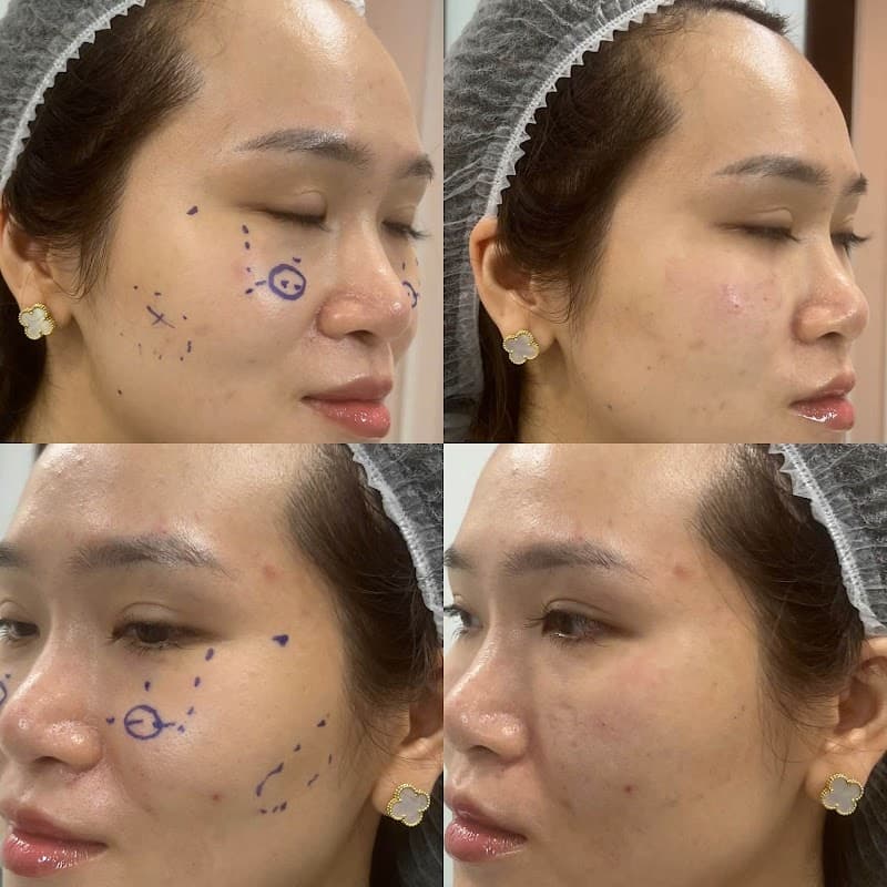 Khử Thâm Môi - Lily Pham Quận Ba Đình photo