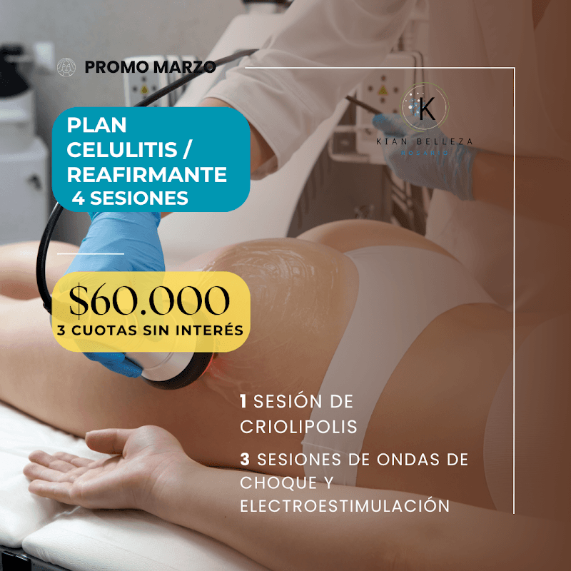 Kia. Centro de Estetica Rosario photo