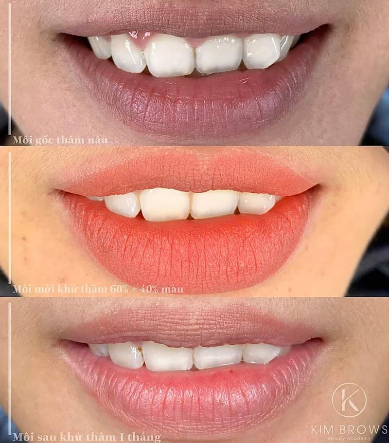 Kim Trinh Beauty-Phun xăm thẩm mỹ Quảng Ngãi photo