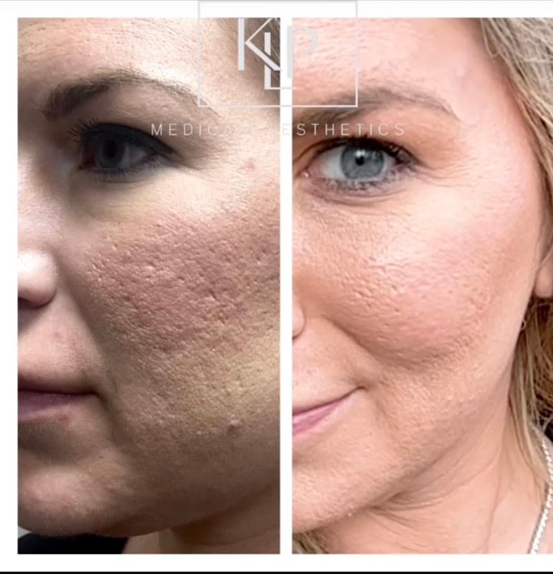 KLP Medical Aesthetics Dallas photo