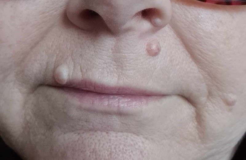 KOL Skin Clinic Worthing photo