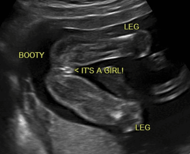 La Bella Belly Spa Rockwall photo