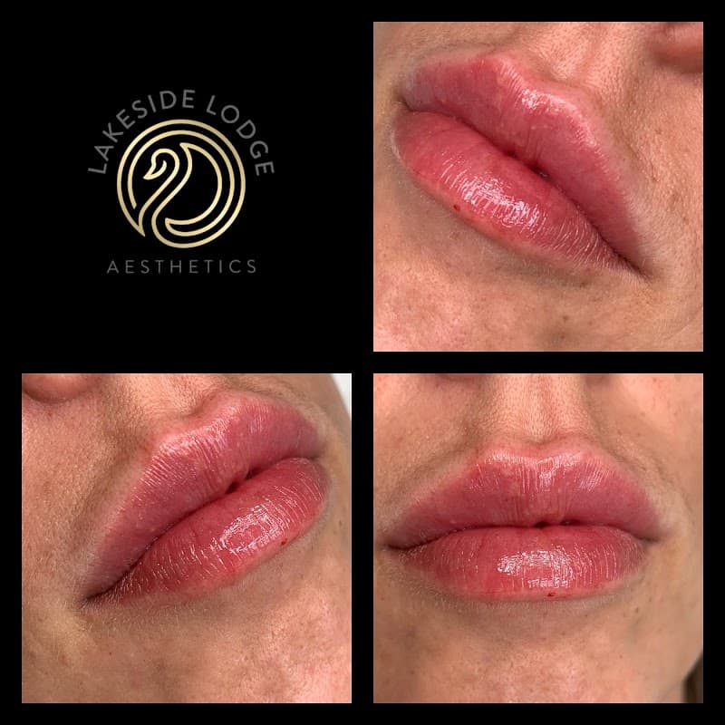 Lakeside Aesthetic Clinic Pontefract photo