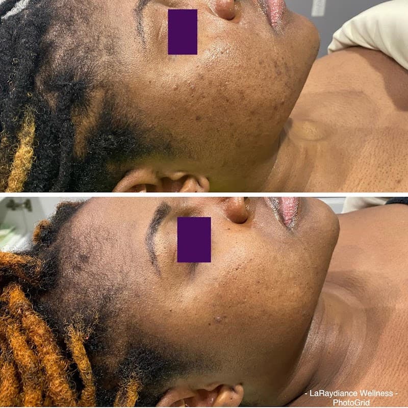 LaRaydiance Wellness Spa Boutique Savage photo