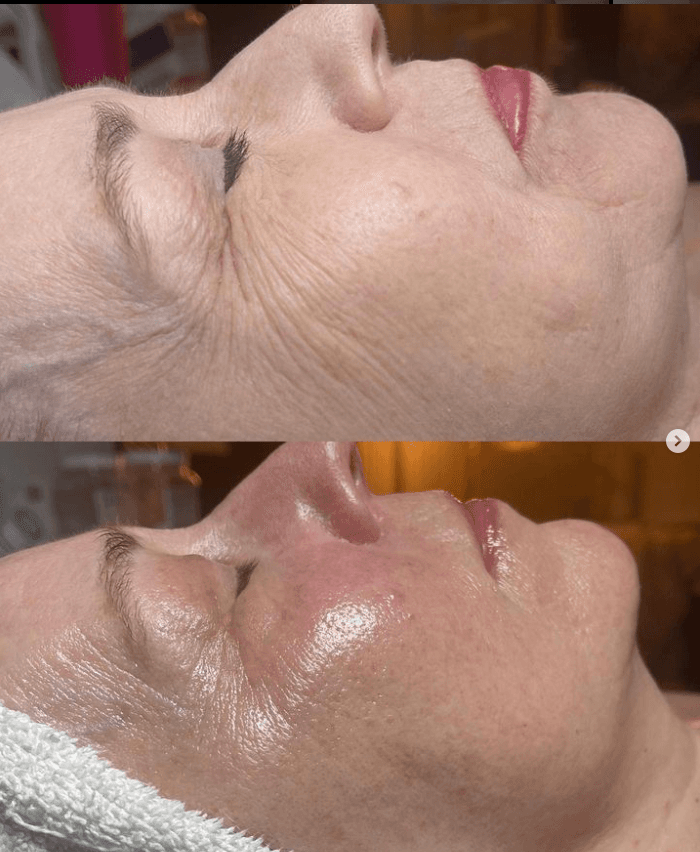 Lauren Jewel Aesthetics Jefferson photo