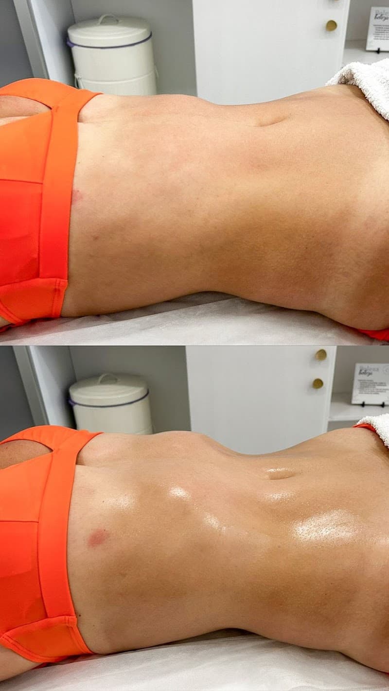 Layane Santos Fisioterapeuta Coimbra photo