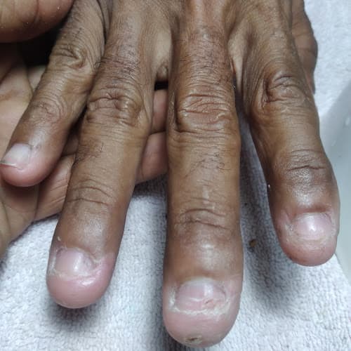 Le Topaz Beauty @ Spa for U San Nicolas photo