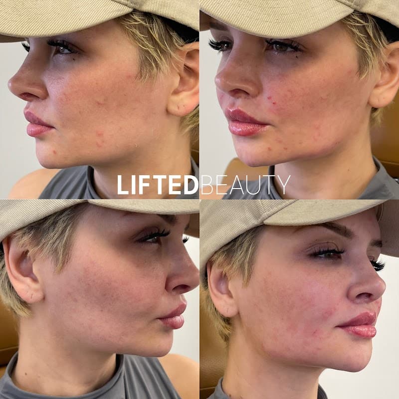 Lifted Beauty Medical La Habra photo