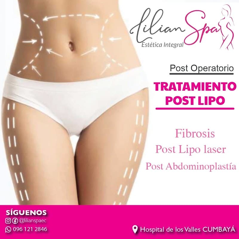 Lilian Spa - Quito photo