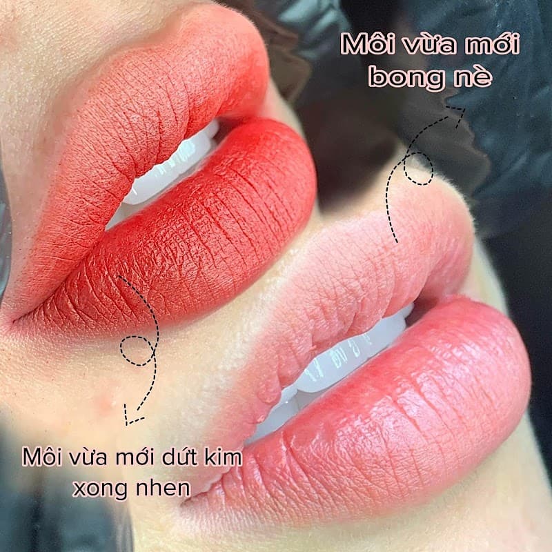 Lin Beauty Spa Thủ Dầu Một photo