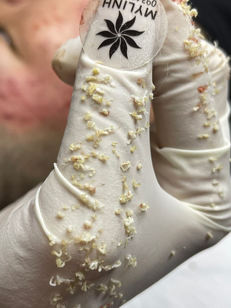 Linh My Đặng Spa Quận Gò Vấp photo